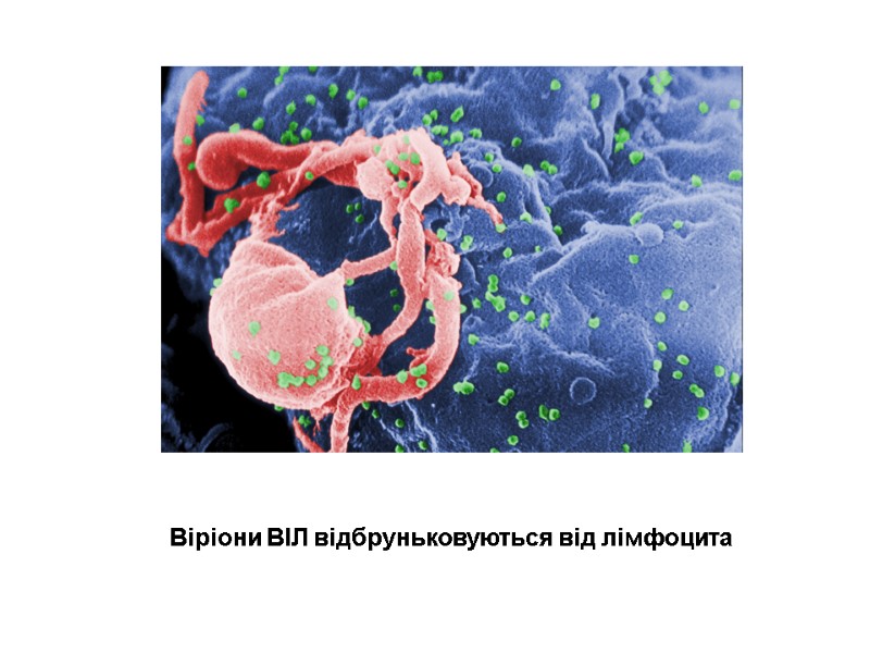 Віріони ВІЛ відбруньковуються від лімфоцита